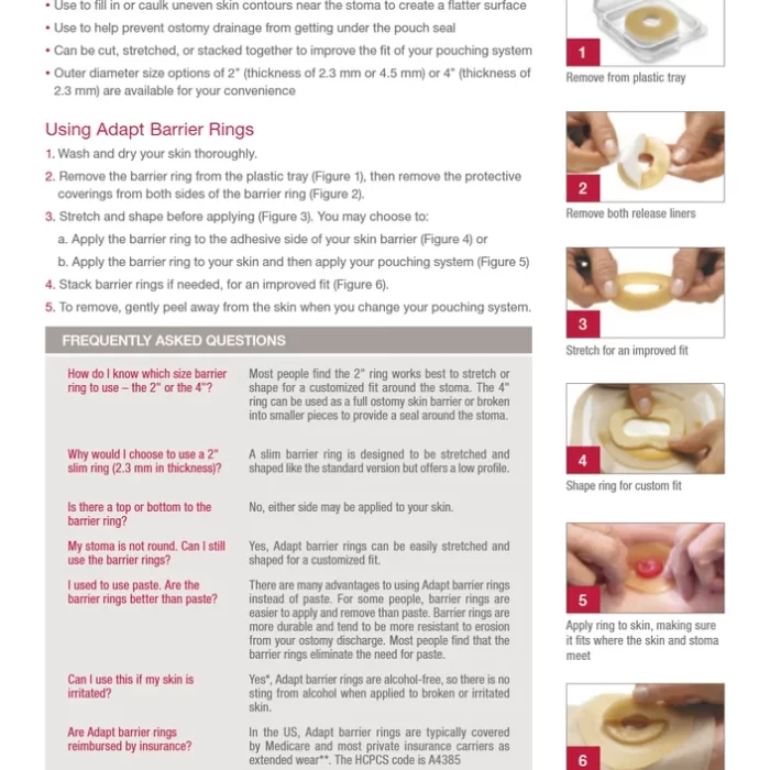 48mm-hollister-7806-adapt-ring-1000x1000